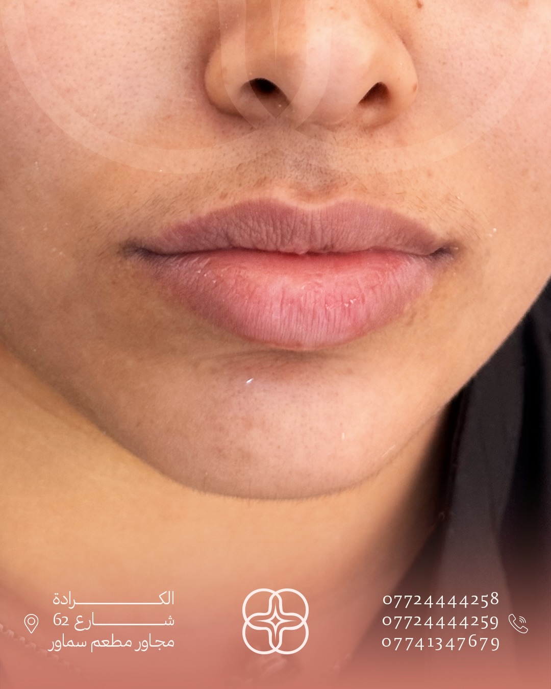 تنسيق الابتسامة